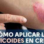 Descubre por qu&eacute; los huesos de mi perro crujen al caminar